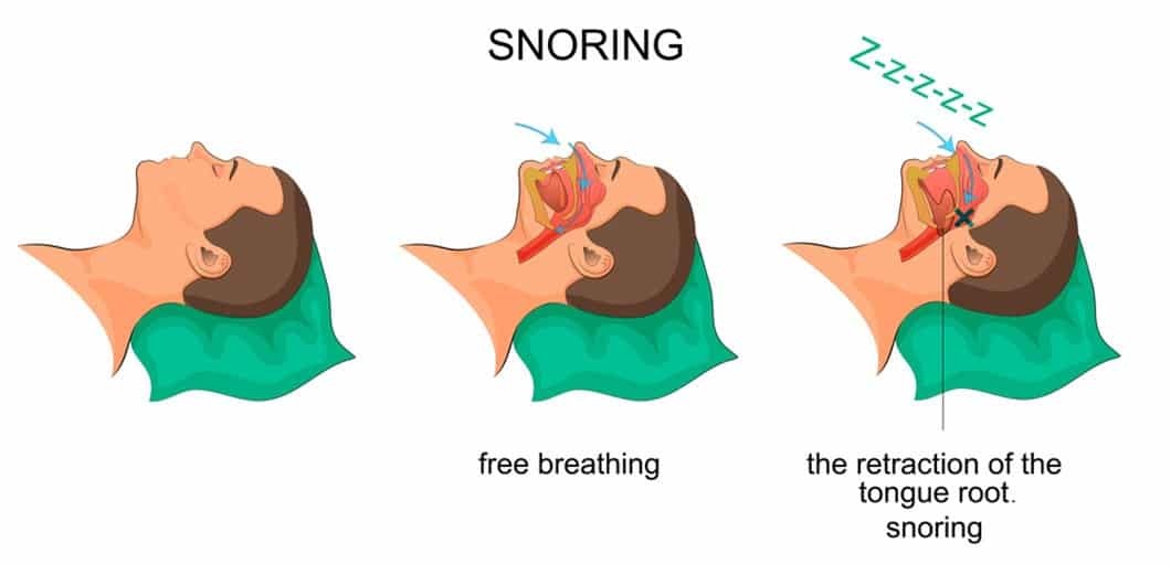 Best Anti Snoring Pillows Top 5 Pillows to Help with Snoring for 2019